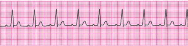 ACLS Algorithms 2023 (Advanced Cardiac Life Support)